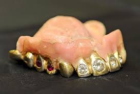 dentadura-dientes-oro-y-ahorrar en tus compras de Apple